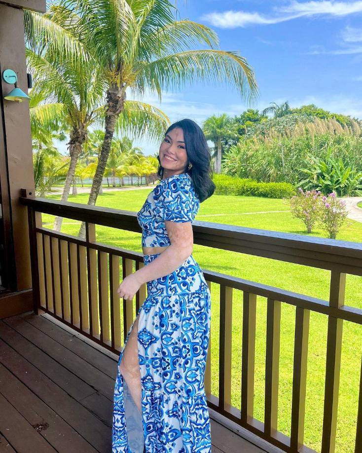 En una entrevista para un medio de comunicación televisivo del país, Michelle Enamorado expresó que alza la voz por esas niñas que sufren lo que ella pasó, “nuestra mente es un arma de doble filo, a veces nosotros mismos somos los que nos limitamos. Desde pequeña soñé con participar en un evento de belleza, pero me limitaba”. Conforme al tiempo y el apoyo de sus padres ahora cumple ese anhelo. 