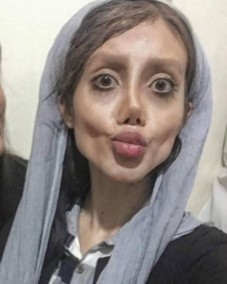 En su cuenta de Instagram, Sahar fue subiendo fotografías en las que muestra su transformación después de las diferentes cirugías que asegura haberse realizado en los últimos meses.<br/>