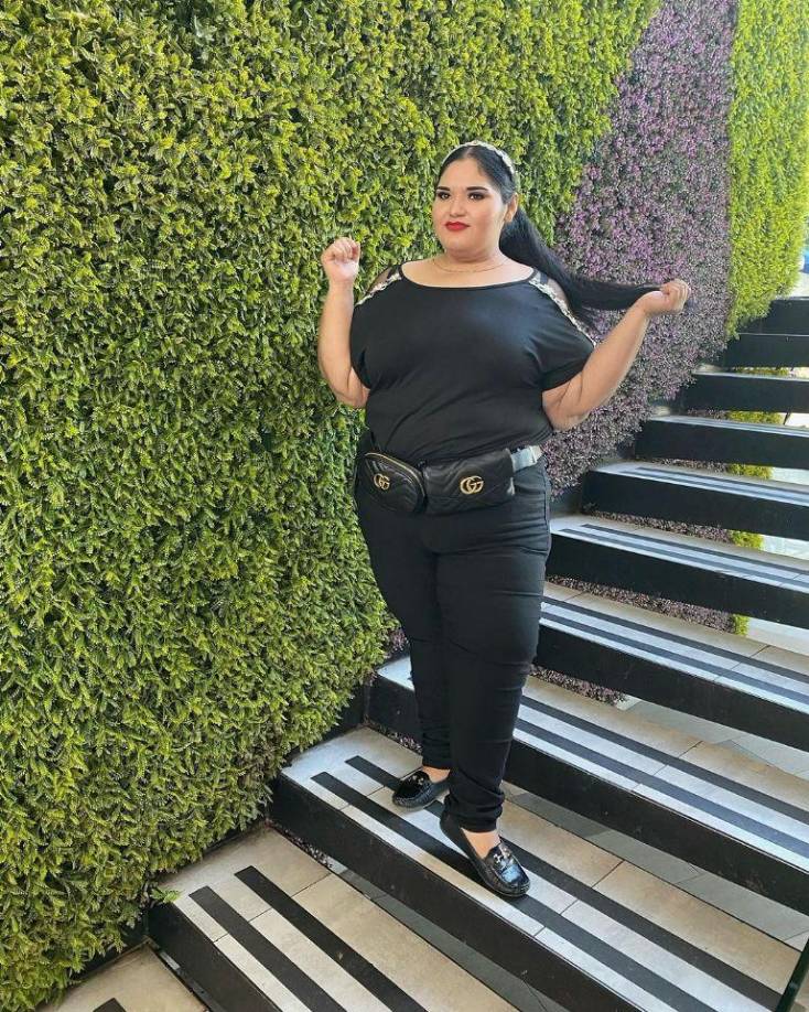 En 2018, la creadora de contenido se <b>sometió a su primera cirugía de manga gástrica</b> con la que logró <b>perder más de 100 kilos</b>. 