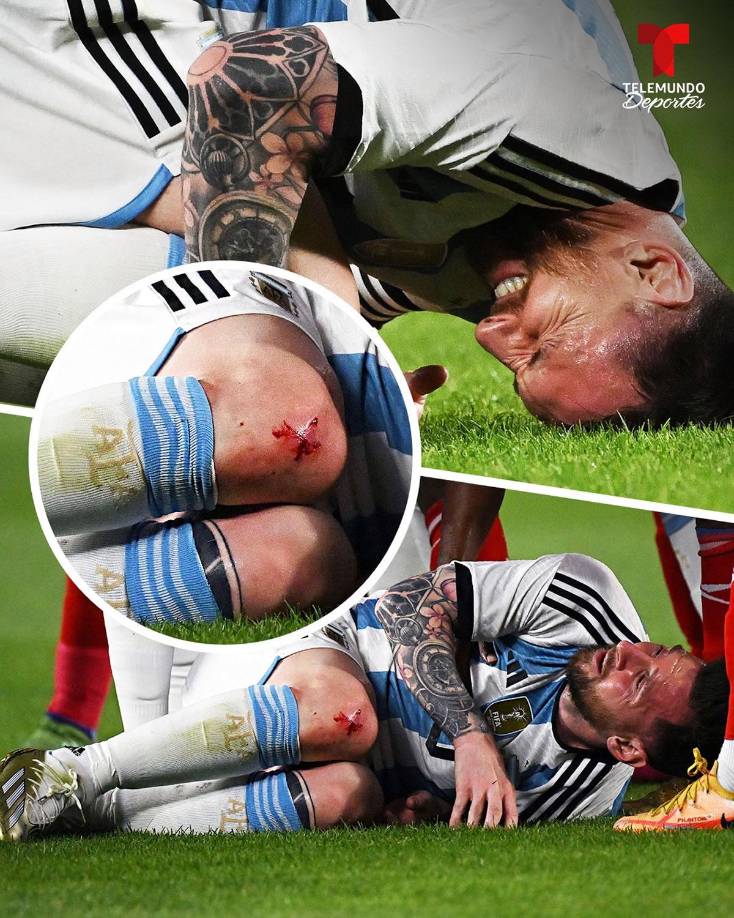 Messi quedó ensangrentado de su rodilla derecha tras la fuerte falta que recibió de los panameños.