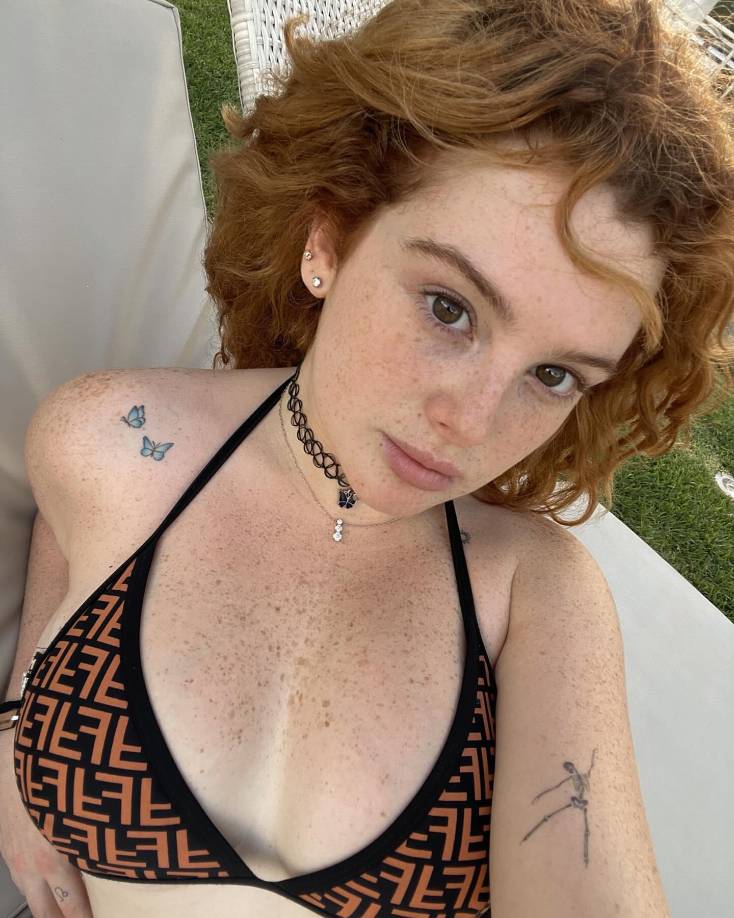 “Vi que en la cara tenía mucho salpullido. Debe ser por las pastillas que está tomando. No está comiendo nada bien. Esperemos que se recupere”, dijo.