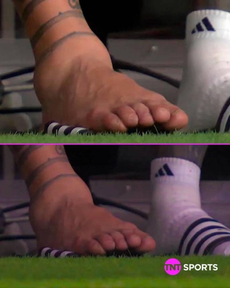 El parte médico del Inter Miami especificó que “tras una evaluación médica, se ha determinado que Leo Messi ha sufrido una lesión en los ligamentos del tobillo de su pierna derecha. La disponibilidad del capitán vendrá marcada por revisiones periódicas y por el desarrollo de su recuperación”.