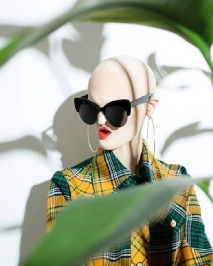 Cuando se le preguntó si su trastorno amarga su vida, dijo: 'No. No me molesta, y nunca lo hizo. O si lo hizo, es porque era algo que la gente me decía que debería estar molesto por ello.'<br/>