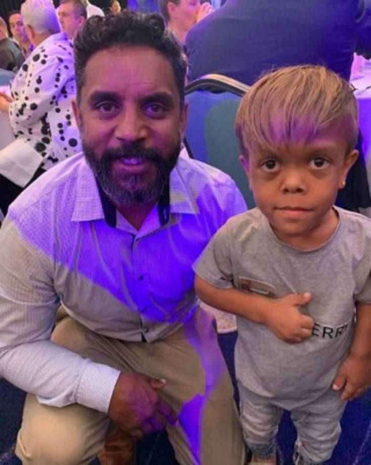 En ocasiones, el enanismo viene acompañado de otros padecimientos como la hidrocefalia, síndrome de Turner, de apnea nocturna del sueño, arqueo de piernas y estenosis del conducto vertebral.<br/><br/>