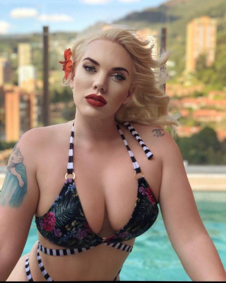 ¿Qué le pasó Jennifer? Le amputan una pierna tras vacaciones