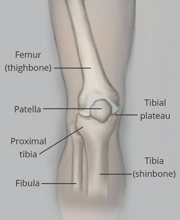 Significado. Esta molestia significa que la sobrecarga de actividad física causó un trauma en el hueso y una grieta.
