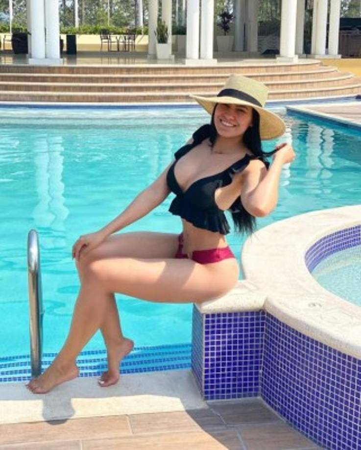 Uno de sus primer procedimientos fue el aumento del busto.