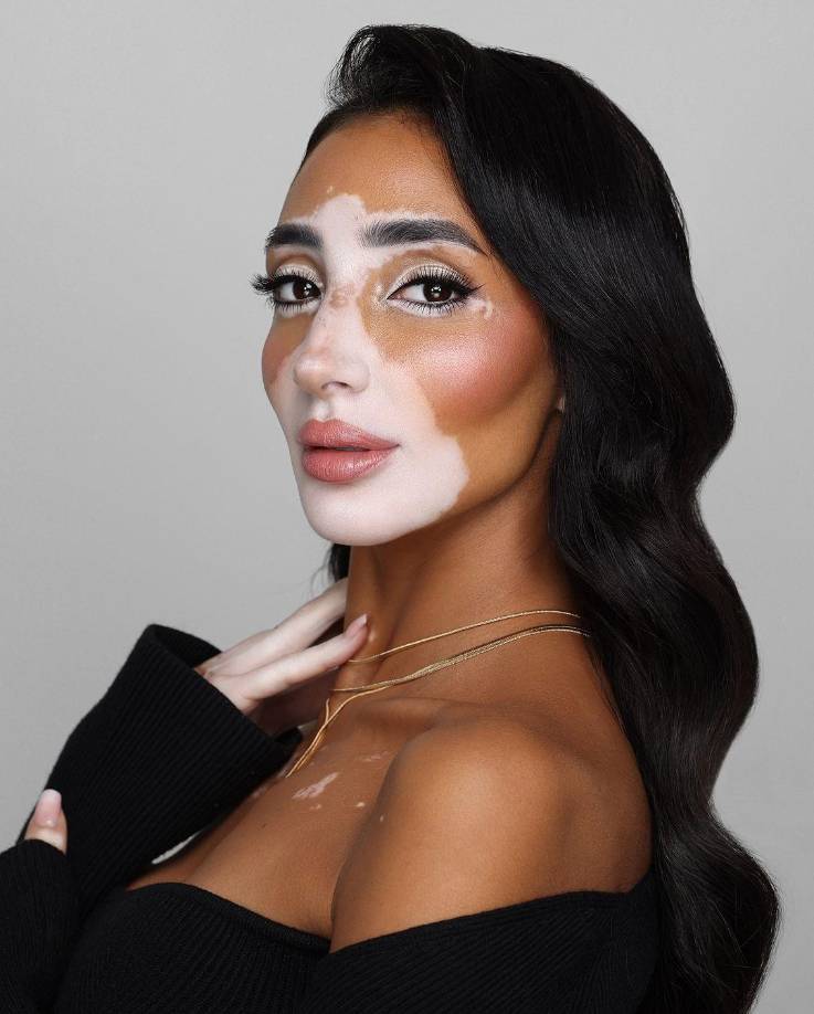 Parte de su trabajo social es ir a las escuelas y universidades para hablar sobre el tema y difundir conciencia sobre el acoso escolar y lo peligroso que es; además ha colaborado junto a Forbes y UNICEF en campañas anti-bullying.