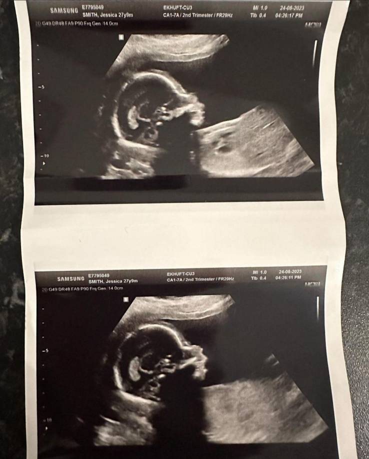 Desde el anuncio donde compartió que se convertiría en madre, la joven ha mantenido en secreto el sexo del bebé.