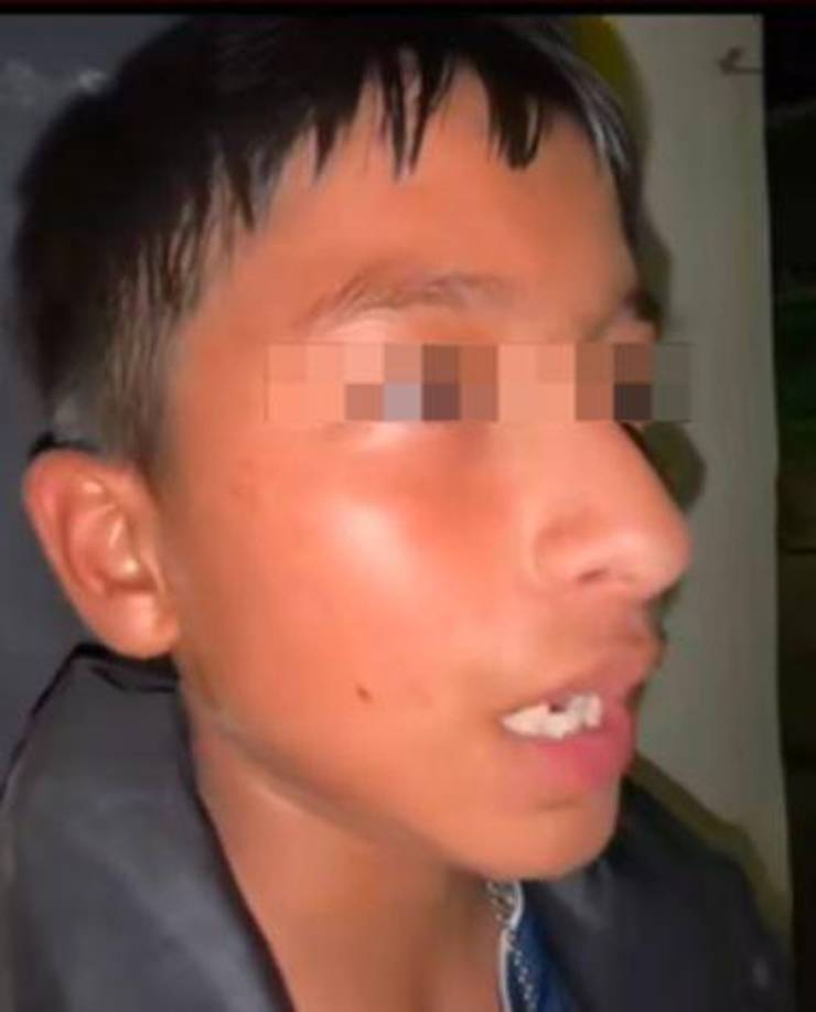 El menor expresó a un periodista mexicano que fue atacado por los policías en México “casi me matan”.