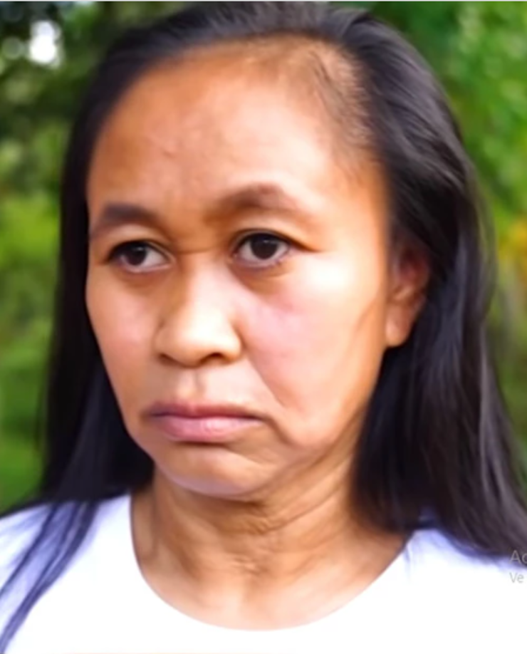 Ante la repercusión del caso de la joven en redes sociales, la familia abrió una cuenta para recaudar fondos y poder costear los tratamientos, que incluyen chequeos para evitar problemas de salud propios de personas de la tercera edad.