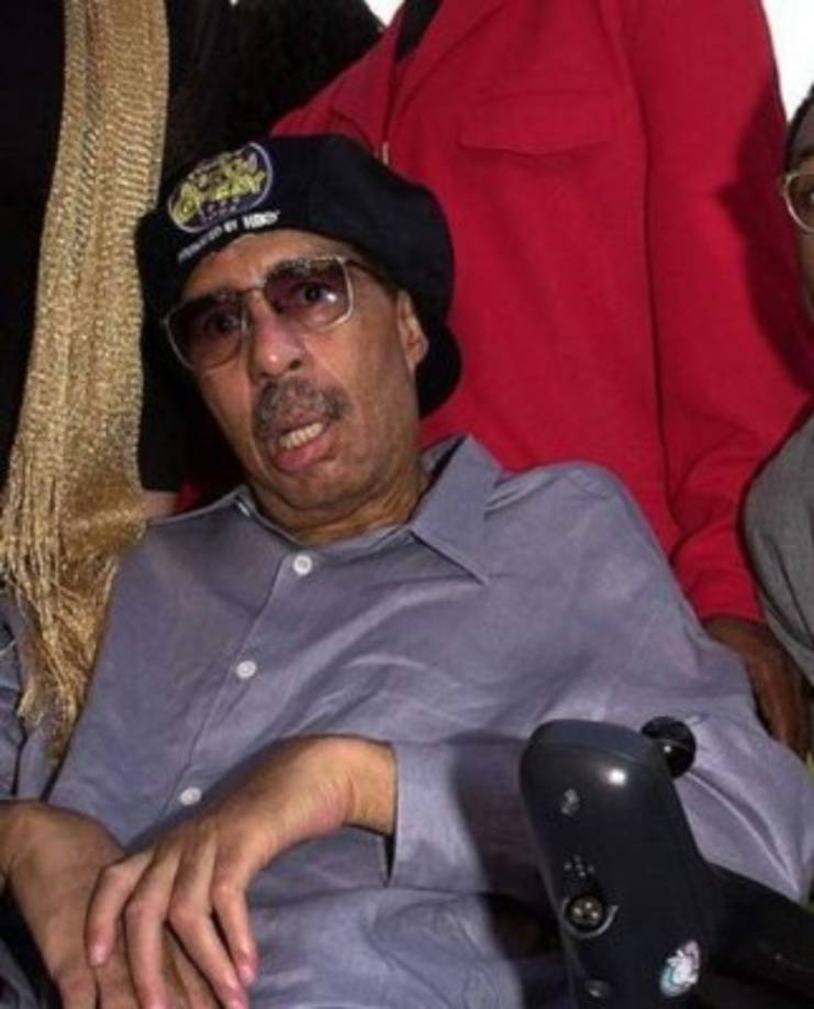 Richard Pryor: El célebre actor y comediante estadounidense falleció el 10 de diciembre de 2005 a la edad de 65 años. Vivió hasta su último día las consecuencias de esta enfermedad degenerativa del sistema nervioso.