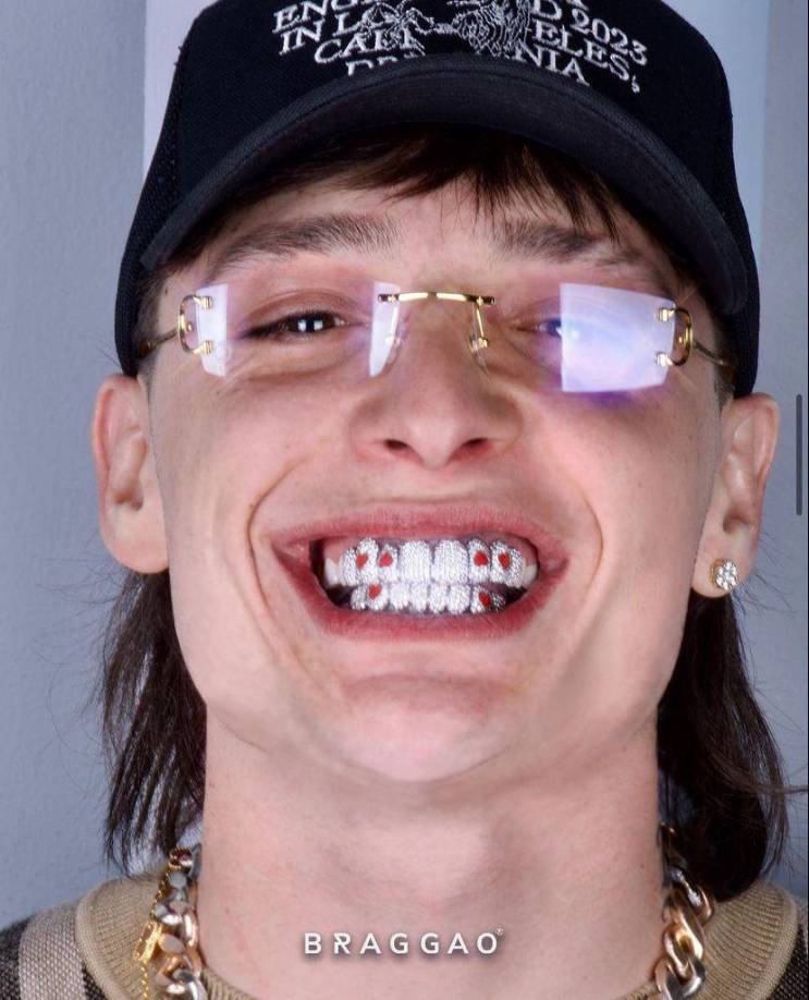 En las imágenes difundidas en redes sociales se puede ver al cantante presumir sus nuevos dientes con incrustaciones de diamantes.