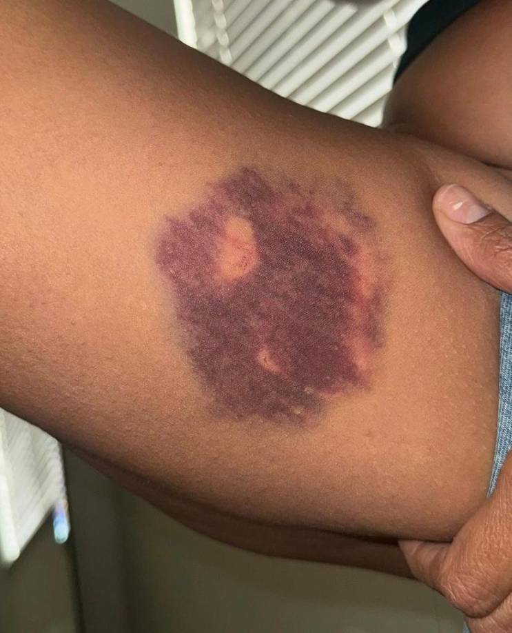 Damas ingresó al apartamento a la fuerza, se dirigió a un dormitorio donde estaba la tiktoker, le apuntó con un arma y disparó un tiro, pero falló.