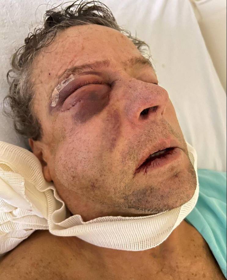 En las fotos se observa su ojo inflamado. 