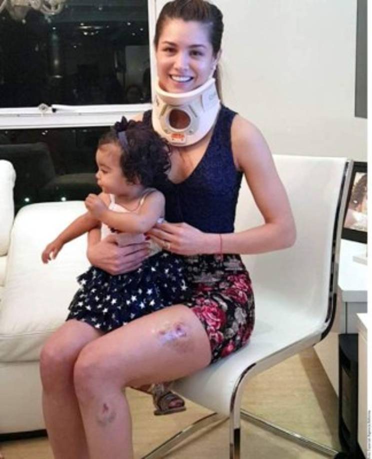 Obviamente a Canales no le pareció esto y se la guardó a Villalobos hasta el fin de semana pasado que se la encontró en el baño del gimnasio.<br/><br/>Fue Villalobos quien informó de esta pelea luego de subir a su Instagram una foto en donde se le ve con rasguños en el área de los pechos, golpes en la cara y mordeduras en las piernas.