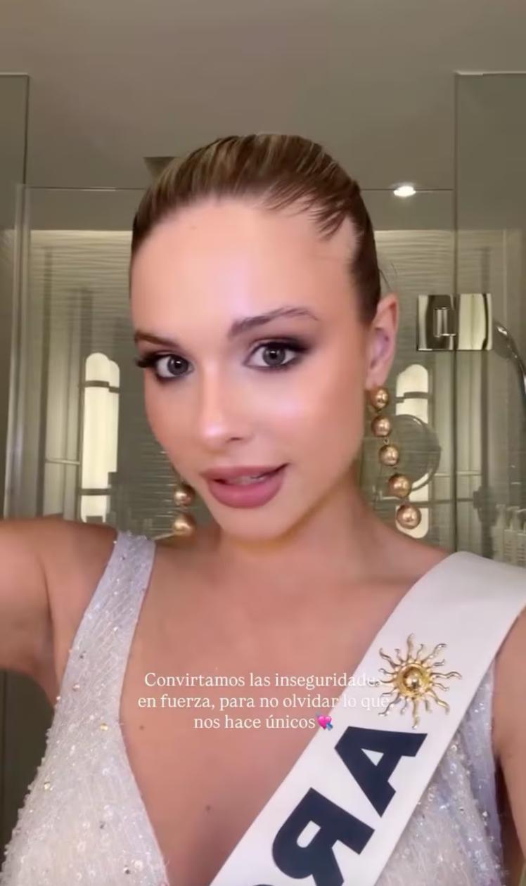 Miss Argentina 2025, Aldana Masset, revela que padece alopecia