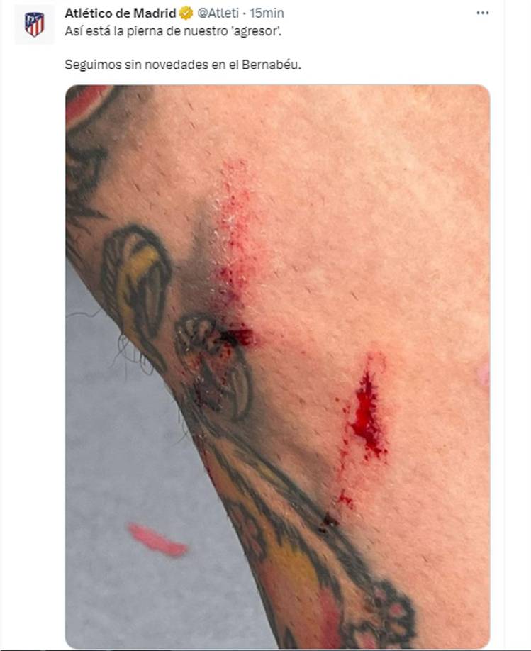 El Atlético de Madrid le agregó más picante al final del derbi madrileño con un polémico mensaje y mostrando cómo quedó la pierna de Ángel Correa, expulsado por una agresión a Antonio Rudiger. “Así está la pierna de nuestro ‘agresor’. Seguimos sin novedades en el Bernabéu”, escribió el club rojiblanco en Twitter.