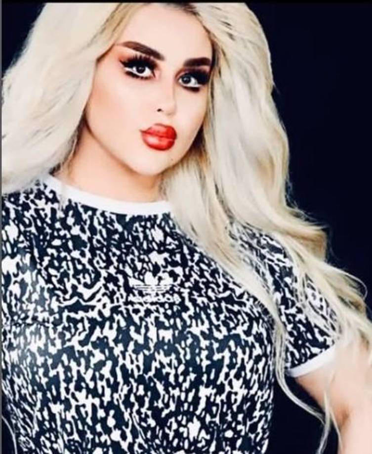 Aunque algunos creen que Dalia sí parece una Barbie y la felicitan por su cambio.