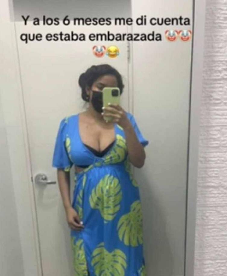 Benguché le dio el dinero a su esposa para realizarse una cirugía plástica en Argentina y a los seis meses se dieron cuenta que estaba embarazada.