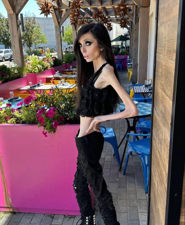 Brenes mencionó que cuando Eugenia estuvo recluida “ella realmente no estaba tan mal”, aunque en el pasado la youtuber había admitido que su delgadez extrema preocupaba a los doctores y que estos incluso no la querían dejar salir del centro de rehabilitación.