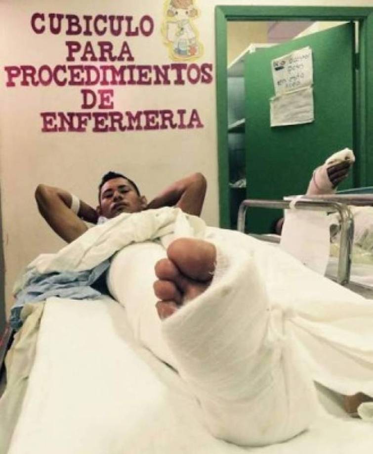 En mayo del 2018 intentó repetir la acción pero terminó en el hospital tras sufrir una caída.