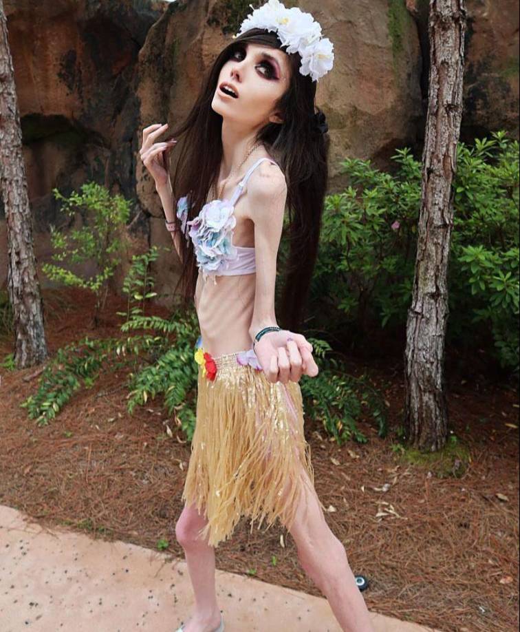 El medio también refiere que algunos grupos sociales que ofrecen apoyo a personas con anorexia han expresado su rechazo al contenido de Eugenia Cooney y han cuestionado a las propias plataformas por no cerrar su espacio y pensar en la salud de la joven, aunque ella admite que se encuentra bien.