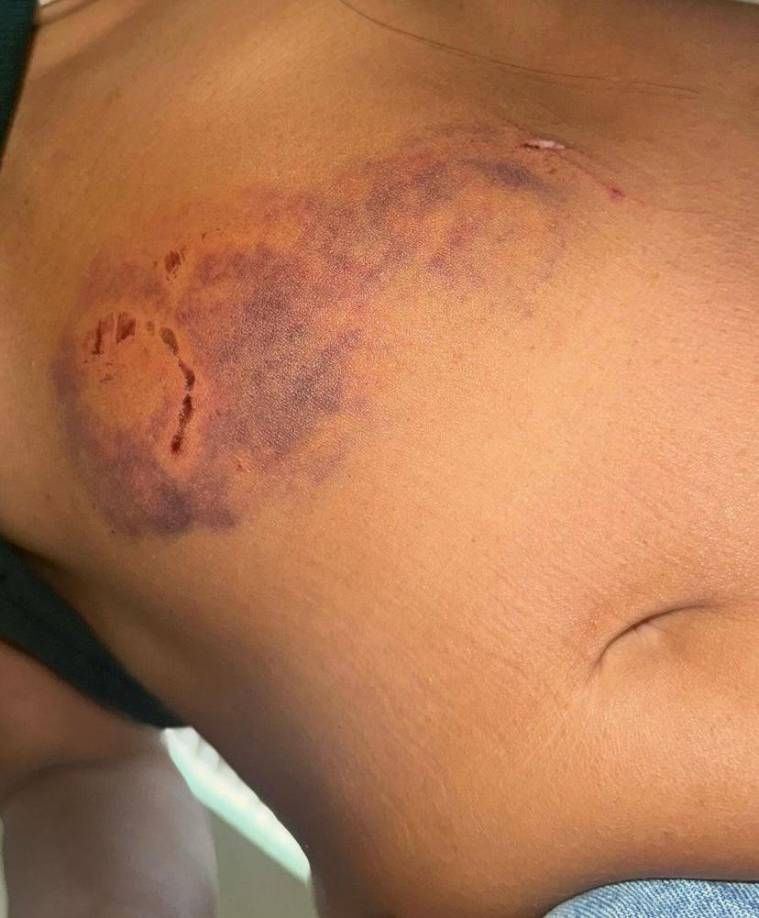 “Mordió a mi mamá y me jaló el cabello muy fuerte. Ambos gritamos pidiendo ayuda, pero nadie nos escuchó. Él seguía intentando dispararme y entre los dos le sujetábamos la mano con la que sostenía la pistola, tratando de evitar que me apuntara”, continuó la joven.