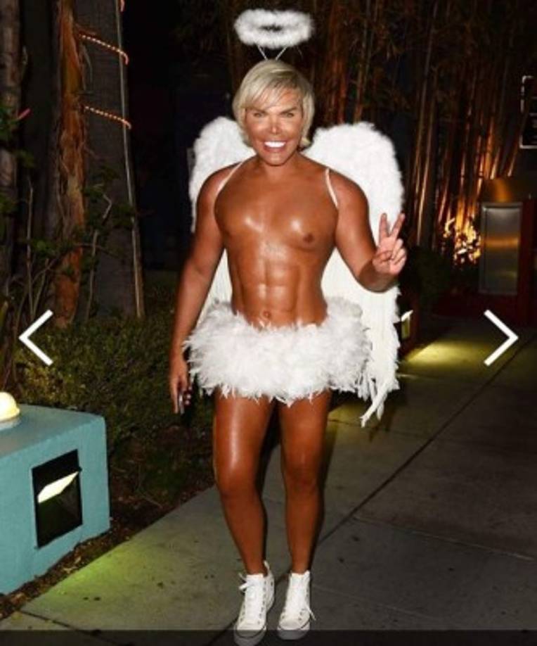 Otro de los procedimientos a los que se sometió hace poco fue un doloroso transplante de cabello que le costó 25 mil dólares, todo para lograr verse más femenino. Actualmente, Alves descartó que se hará un cambio de sexo.