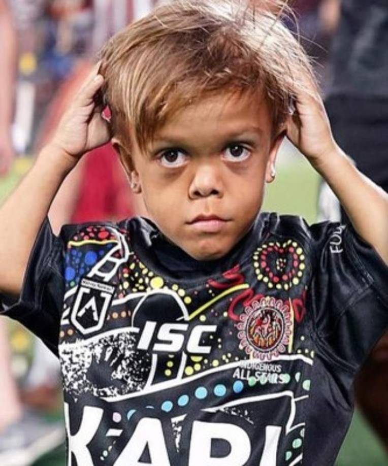 Pero luego de haber pasado mucho tiempo sin ir a la escuela, decidió ir para ver a unos grupo de deportistas que visitarían la institución y con la fe de que esta situación no se iba a volver a repetir, pero lastimosamente volvió a ocurrir y de una forma más violenta.