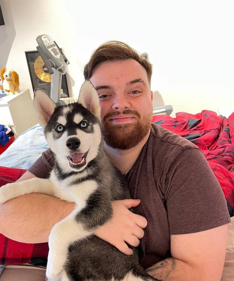 Al principio, los médicos indicaron al vasco que creían que padecía este problema debido a una infección de herpes que sufrió en su ojo izquierdo cuando tenía 6 años, pero tras someterse a varias pruebas, han terminado desestimando esta posibilidad. 