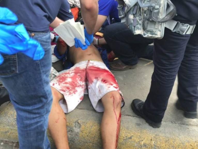 Según el Centro Nicaragüense de Derechos Humanos (Cenidh) más de 79 personas resultaron heridas durante la violenta jornada y al menos 11 murieron.