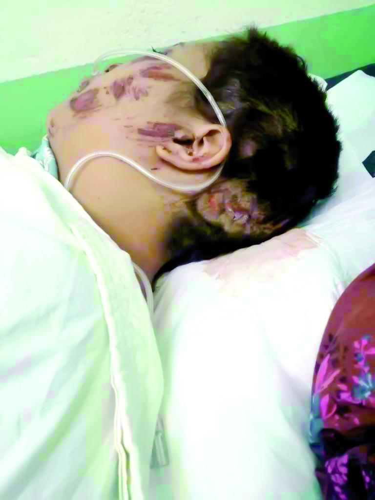 A Hazle Michel Cortés su atacante le pasó un carro varias veces sobre su cuerpo.