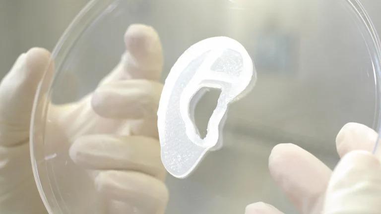 AuriNovo, el nombre del implante, fue desarrollado por la empresa 3DBio Therapeutics.