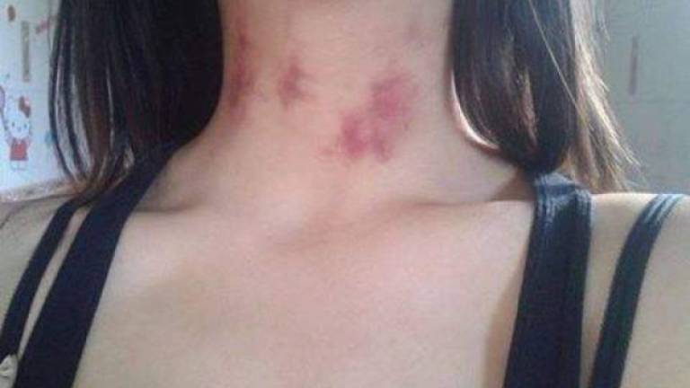 El novio compartió la foto del cuello de su chica.