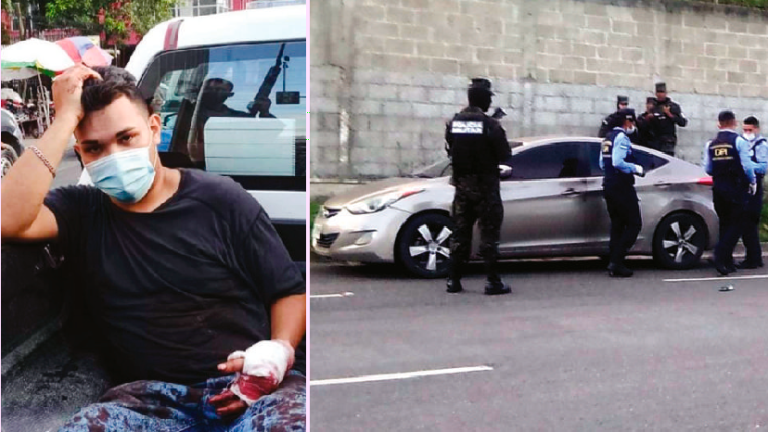 Como Abel Enrique Coto fue identificado el supuesto responsable del asalto, el carro en el que huyó fue decomisado por la Policía.