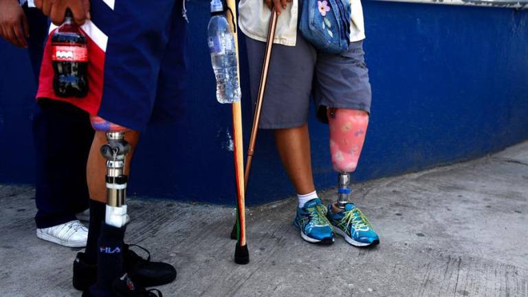 Pacientes con prótesis colocadas en el mes de julio realizan sus primeras terapias y prácticas para adaptarse, en el Instituto Guatemalteco de Seguridad Social.