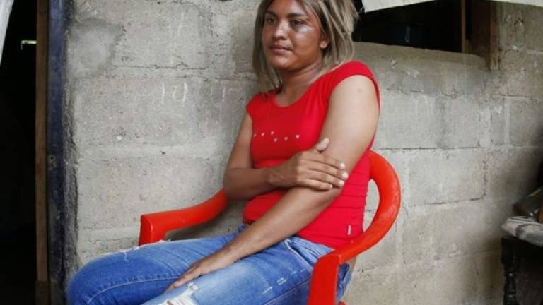 El transexual hondureño Darwing René Reyes conocido como'Shakira'.