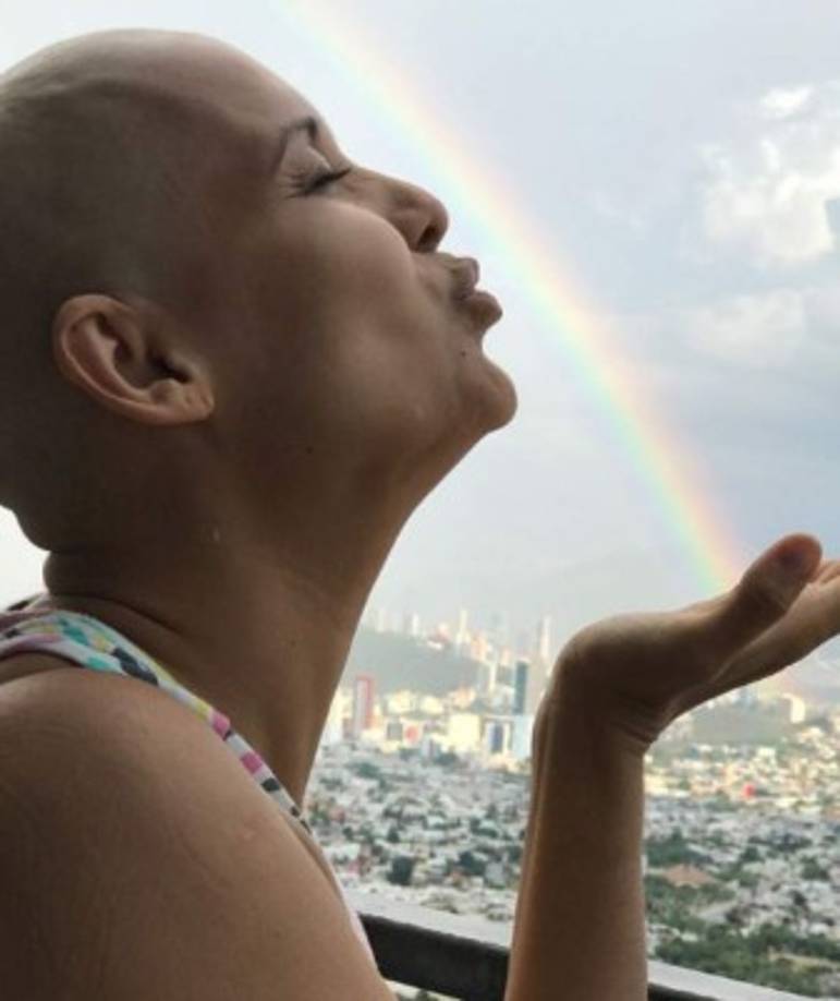 Luna se sometió a varias sesiones de quimioterapia.