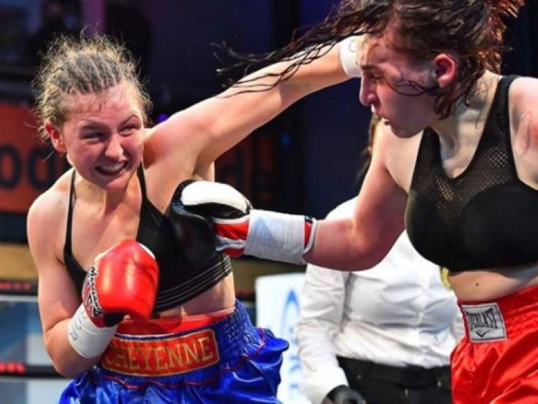 La peleadora germana ha mostrado las impactantes consecuencias en su rostro de un terrible cabezazo que sufrió en la cara durante su combate contra Alina Zaitseva.