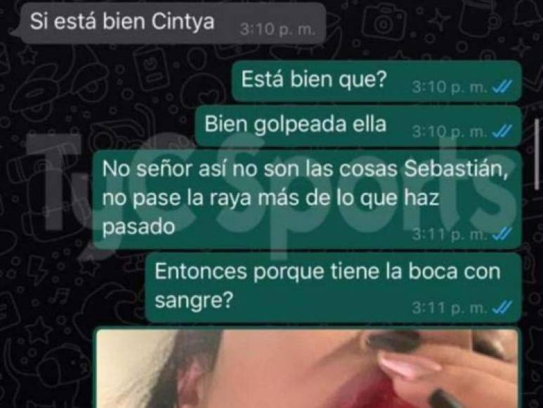 Cinthya Cortés, hermana de Daniela, le volvió a reclamar al jugador de Boca por haber agredido a su familiar y le adjunta la foto de cómo la dejó tras la agresión.
