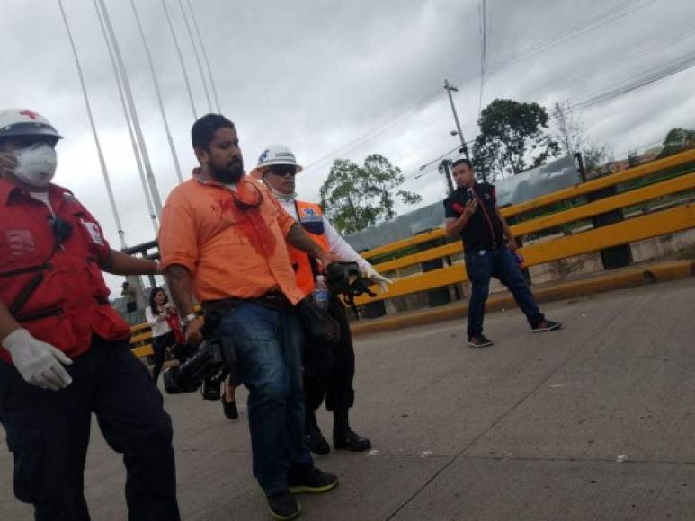 Un camarógrafo herido en desalojo de una protesta en universidad de Honduras- AFP