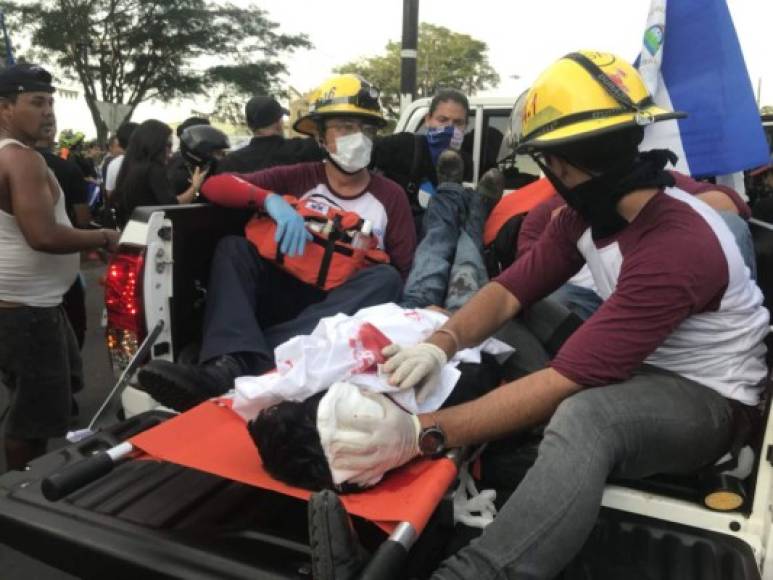Medios locales informaron que grupos paramilitares y policías dispararon contra cientos de manifestantes, que marchaban con las madres que perdieron a sus hijos en las violentas protestas de las últimas semanas en Nicaragua. Foto: Wilfredo Miranda.