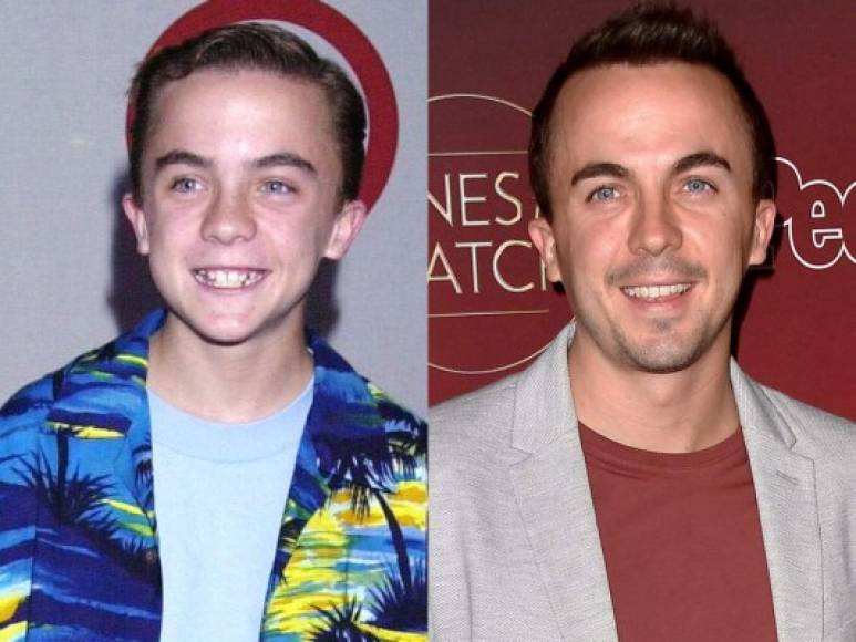 Malcolm Wilkerson / Frankie Muniz.<br/>El protagonista de la serie, Malcolm Wilkerson, fue interpretado por Frankie Muniz, quien ahora tiene 34 años. El actor gozó de fama internacional y fue uno de los actores adolescentes mejor pagados de principios del 2000, pero abandonó la actuación por un periodo, para dedicarse al automovilismo. <br/>Su última participación en la TV fue en el reality show 'Total Bellas'. Antes de eso apareció en 'Sharknado 3' y en 'Dancing with the Stars'. Ahora se dedica a vender aceite de oliva.<br/>