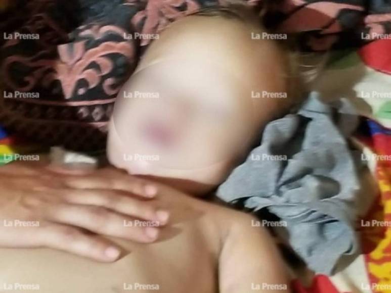 Este nuevo episodio se dio en el municipio de Concepción del Norte, Santa Bárbara y recuerda al caso de otro niño, un pequeño albino de 18 meses que 'revivió' en cinco ocasiones en El Negrito, Yoro.<br/><br/><br/>No hay expertos en la zona que puedan determinar si este caso o el anterior puedan tratarse de catalepsia.<br/><br/>La catalepsia es un trastorno nervioso repentino que se caracteriza por la inmovilidad y rigidez del cuerpo y la pérdida de la sensibilidad y de la capacidad de contraer los músculos voluntariamente.<br/>