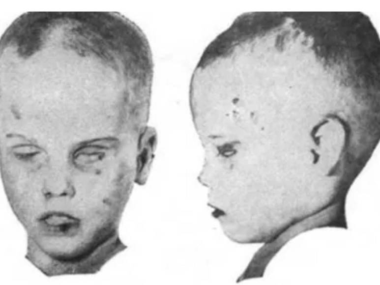 En lo que se conoce como el caso del “Niño en la Caja”, su cuerpo fue descubierto envuelto en una manta dentro de una caja de cartón el 25 de febrero de 1957.