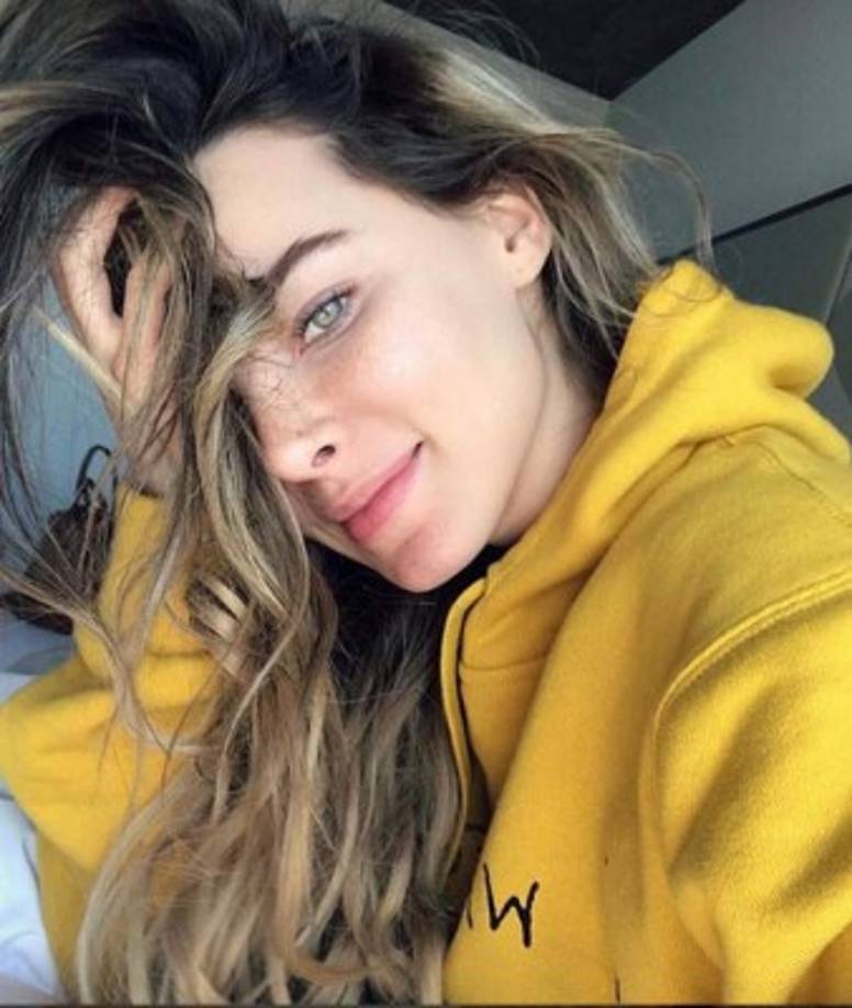 Luciendo su cabello desaliñado y las pecas en su rostro, la cantante de 28 años enamoró a sus fans al mostrar su verdadera cara.