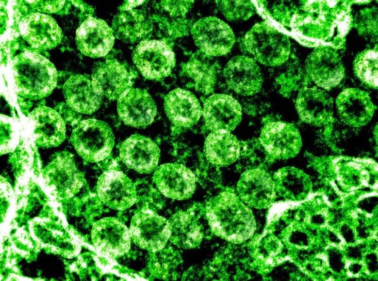 Esas puntas son las que usan para adherirse a la membrana de la célula víctima; fusiona su membrana grasosa (el lípido) con la de la célula y logra penetrar en ella, y hacer que la célula misma tome ese ARN y comience a replicarlo; llegará a fabricar millones de copias antes de morir.