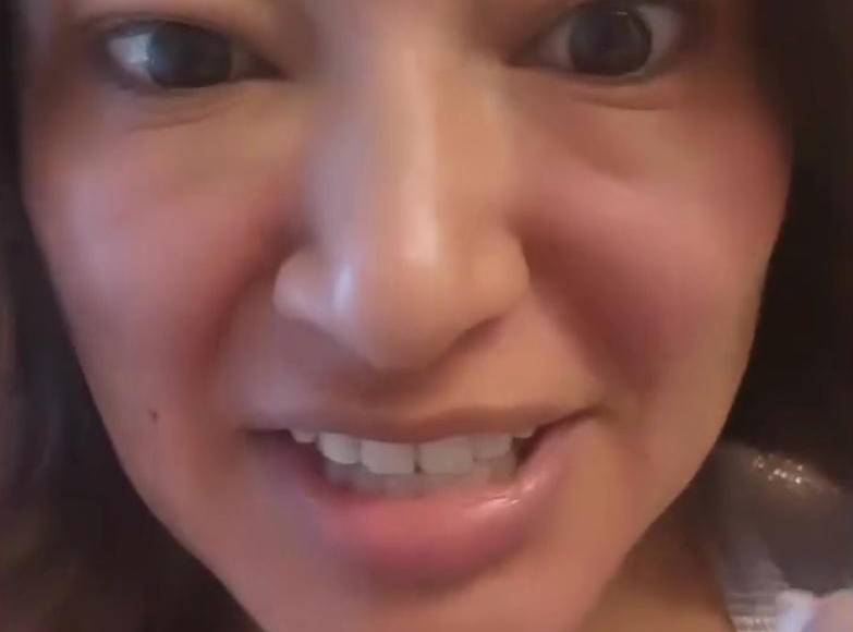 ”Estoy super roja y me pica, parece que me hubieran pegado en el ojo”, agregó mientras mostraba su rostro claramente afectado. 