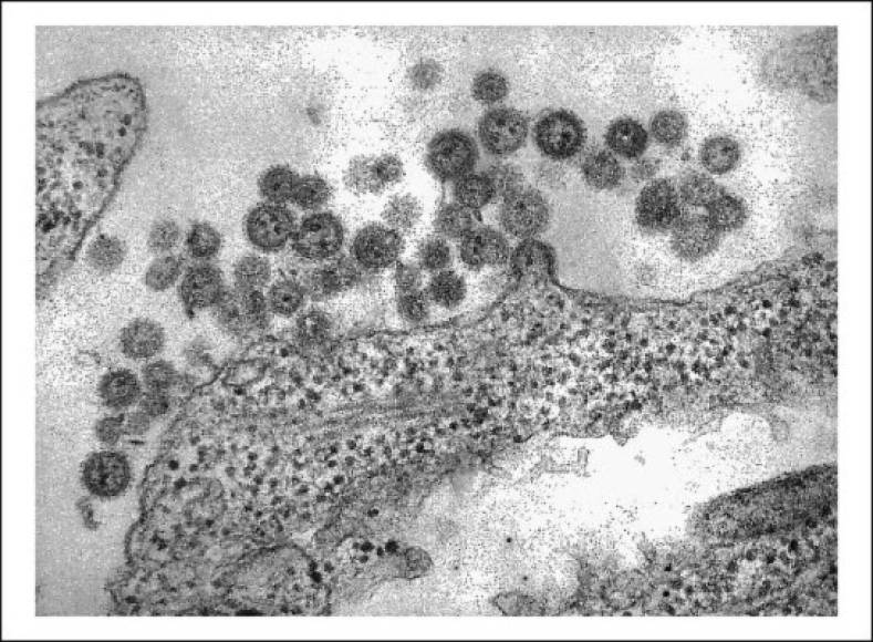 Virus Machupo - La cepa de este virus provoca una patología grave llamada fiebre hemorrágica boliviana o tifus negro. Los infectados padecen migrañas, dolores corporales agudos, fiebre alta y hemorragias. Fue identificado en 1959 y tiene una tasa de mortalidad de 5 a 30 por ciento.